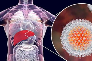 Hepatitis A, Chronic Hepatitis B, Hepatitis C, Hepatitis E Treatment in Bangalore